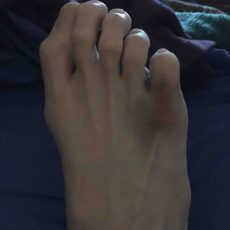 #ouch #ouch