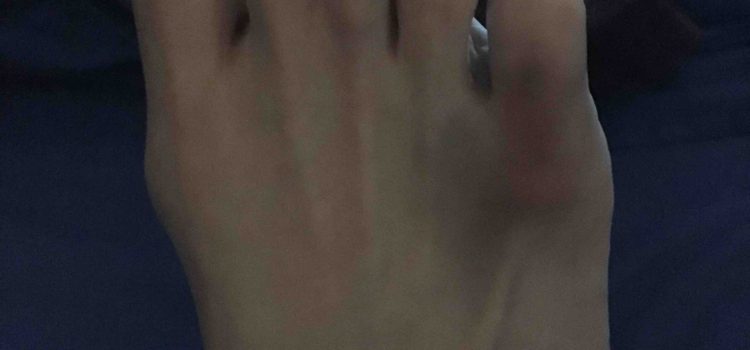#ouch #ouch